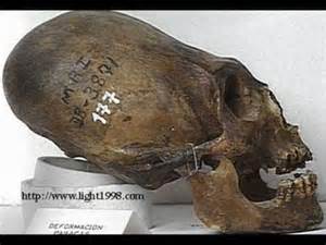 Nephilim skull: You cannot see the suture line that is different from human. L.A. Marzulli had skulls tested & they are Not human.